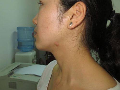 上海琥裳医疗美容门诊部详细的预约挂号方式及流程