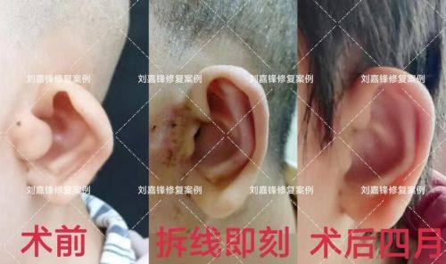 延吉森林语言医学美容诊所真人口碑评价怎么样？