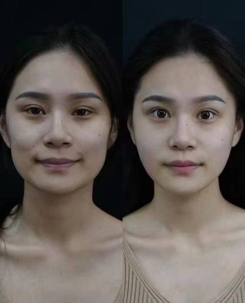 上海琥裳医疗美容门诊部真人口碑评价怎么样？