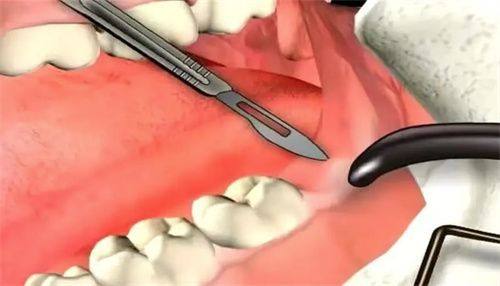 阳江江城皓能口腔诊所特色项目及技术优势