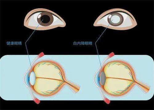 苍南县人民医院眼科详细的预约挂号方式及流程