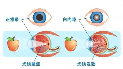 秦皇岛市中医医院眼科是正规医院吗?