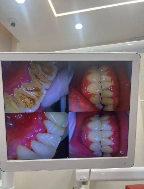 杭州银湖口腔数字化种植矫正中 心（高桥万达广场店）详细的预约挂号方式及流程