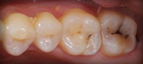 宁波鄞州百丈苑口腔门诊部是正规医院吗？