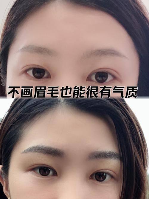 上海碧莲盛植发是正规医院吗？