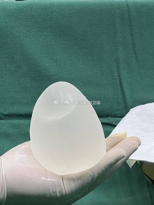 鸡西Dr.W王医生整形外科门诊部是正规医院吗?