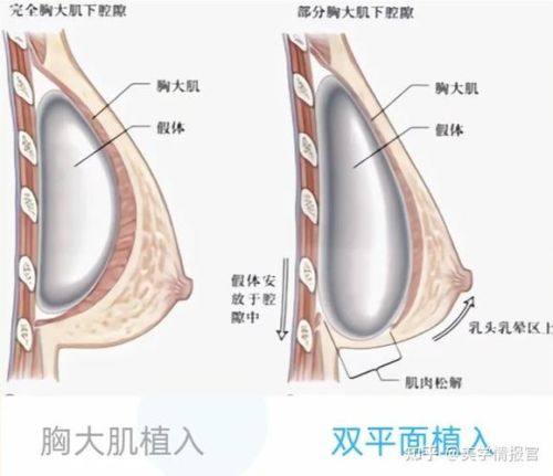 北京斯凯丽雅医疗美容诊所真人口碑评价怎么样？