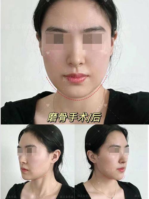 上饶市双博医疗美容是正规医院吗？