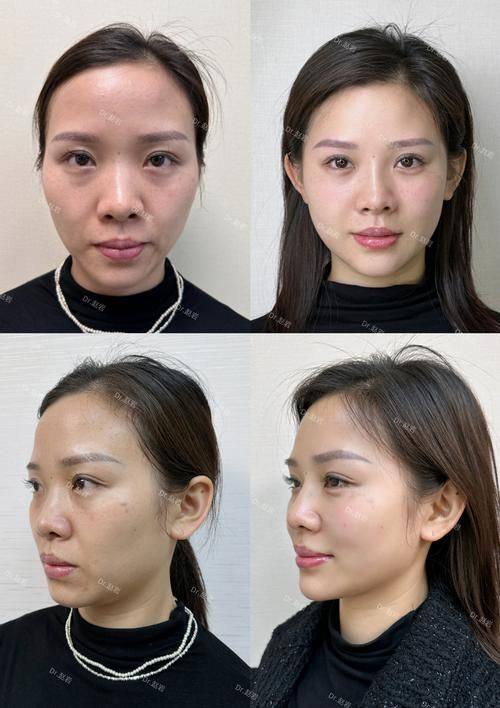 杭州俪仁医疗美容医院详细的预约挂号方式及流程