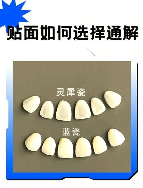 杭州银湖口腔数字化种植矫正中 心（高桥万达广场店）真人口碑评价怎么样？