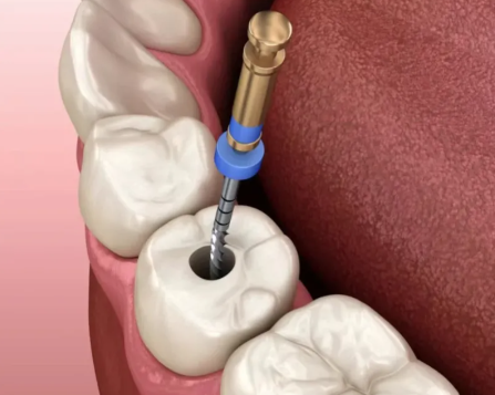 宁波鄞州百丈苑口腔门诊部特色项目及技术优势