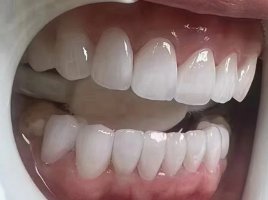 南京雅度口腔门诊部真人口碑评价怎么样?