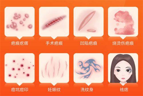 成都伊姿依美医疗美容诊所真人口碑评价怎么样?