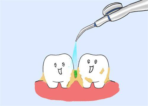 杭州江干陈有根口腔诊所是正规医院吗?