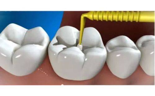 成都温江博恩口腔诊所收费价格表/收费标准