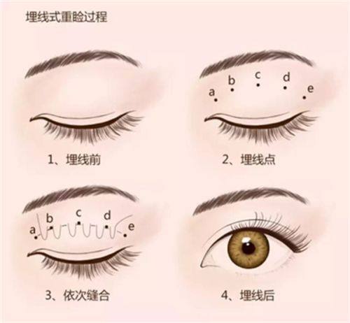 长春于荷琴医疗美容诊所是正规医院吗?