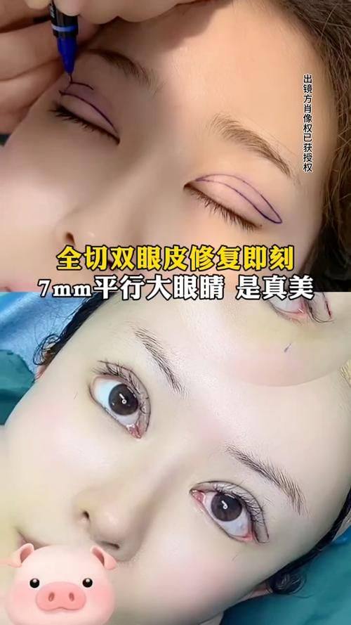 镇雄韩姿整形医院收费价格表/收费标准