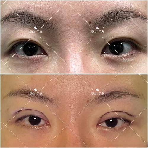 镇雄韩姿整形医院是正规医院吗?