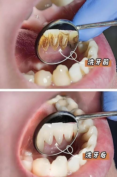 成都温江博恩口腔诊所真人口碑评价怎么样?
