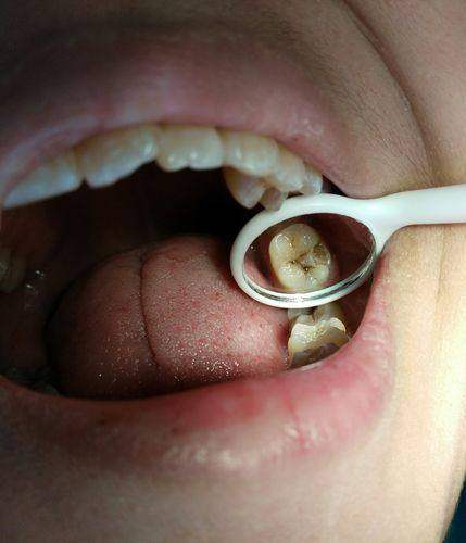 张家界牙博仕口腔真人口碑评价怎么样?