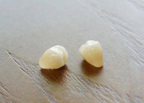 咸阳秦都益牙优口腔诊所是正规医院吗？