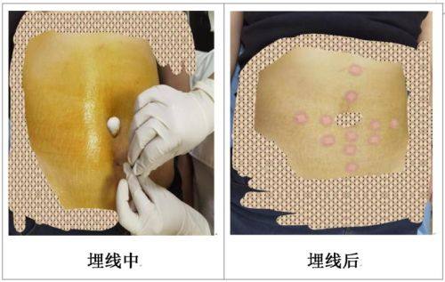 镇雄韩姿整形医院详细的预约挂号方式及流程