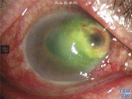 杭州明镜眼科是正规医院吗?