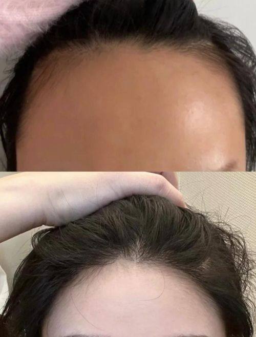 唐山艾丽妮医疗美容诊所是正规医院吗?