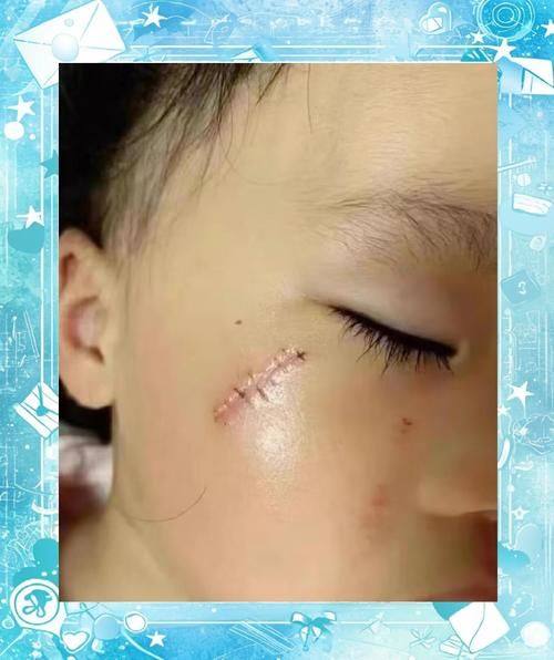 长春于荷琴医疗美容诊所真人口碑评价怎么样?