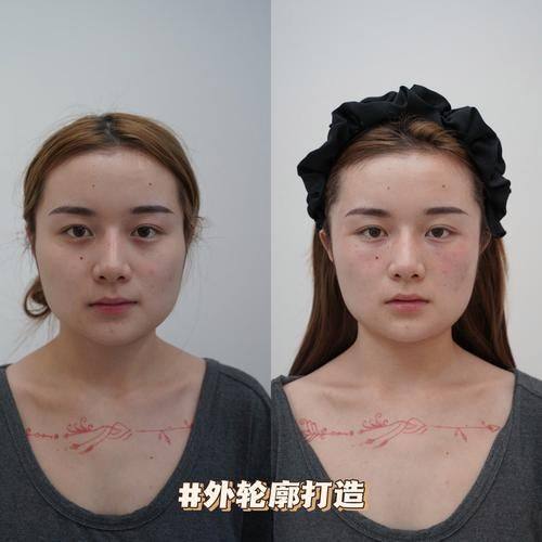 长春市蓝鑫医疗美容门诊部医生团队实力强大及骨干医生简介