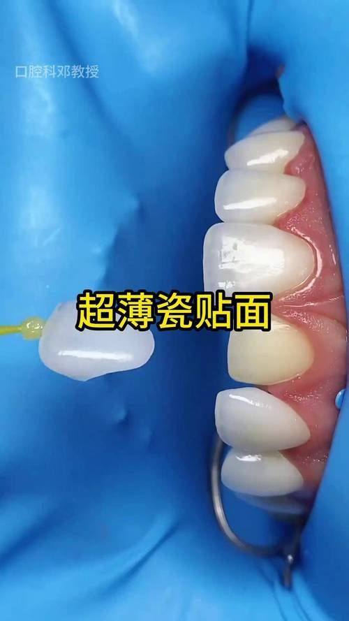 张家界牙博仕口腔特色项目及技术优势