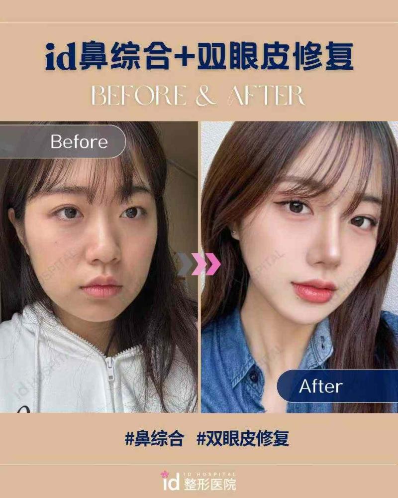 唐山艾丽妮医疗美容诊所收费价格参考