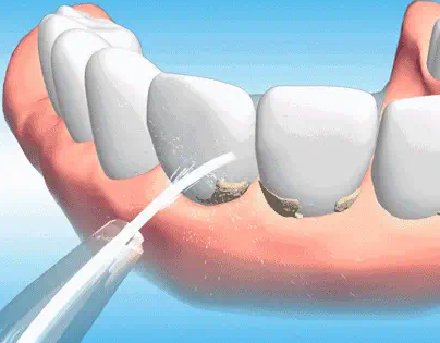 张家界牙博仕口腔地址电话营业时间