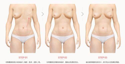 惠水县人民医院是正规医院吗？