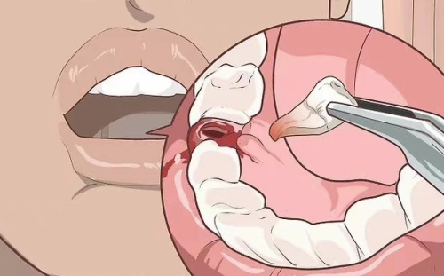 江西新余美佳口腔门诊部详细的预约挂号方式及流程