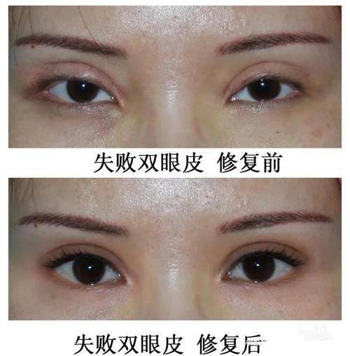 韩国新蒂瑞娜整形医院地址电话营业时间