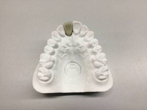 江西新余美佳口腔门诊部特色项目及技术优势