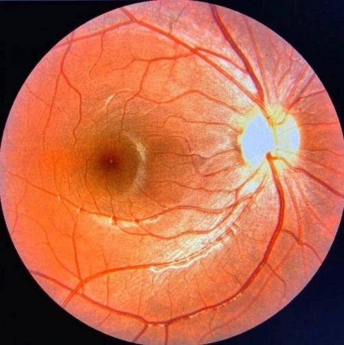 昆明市儿童医院眼科是正规医院吗？