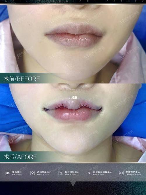 南京怡柏芬医疗美容诊所详细的预约挂号方式及流程