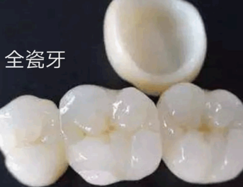 和田阿里口腔诊所特色项目及技术优势