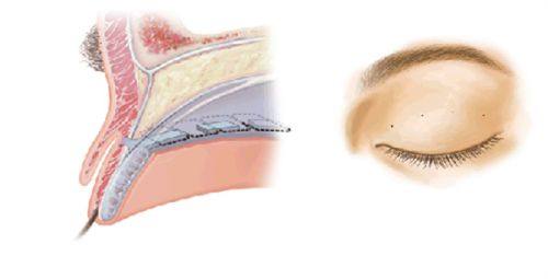成都美钰蓉美整形医院收费价格表/收费标准