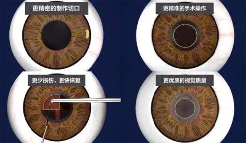 东莞光明眼科医院地址电话营业时间