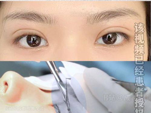 杭州优医联合医美真人口碑评价怎么样?