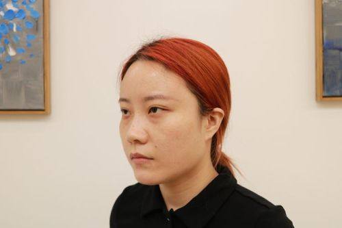 成都美钰蓉美整形医院特色项目及技术优势