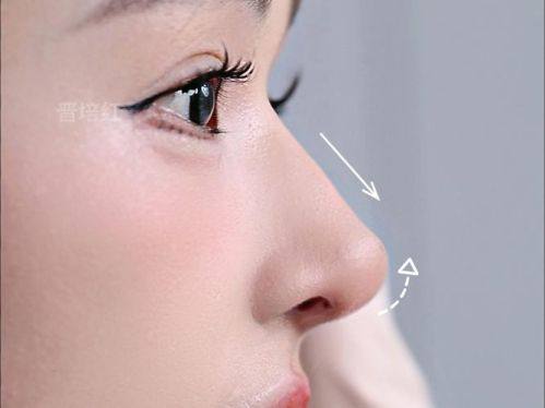 杭州优医联合医美收费价格表/收费标准