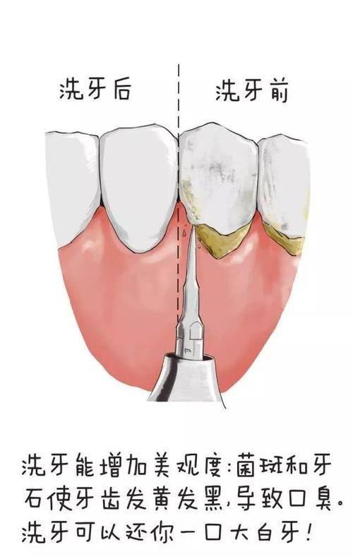 杭牙集团钱塘牙科医院是正规医院吗?