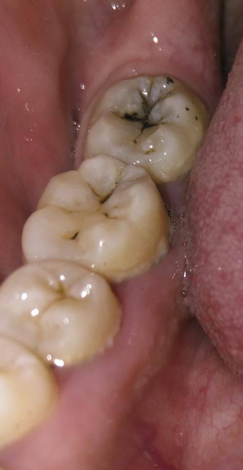 杭牙集团钱塘牙科医院特色项目及技术优势