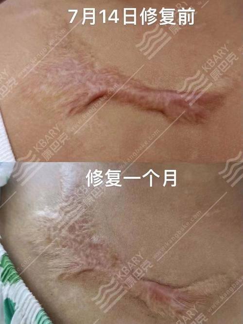 天津河东菲丝澜医学美容门诊部是正规医院吗？