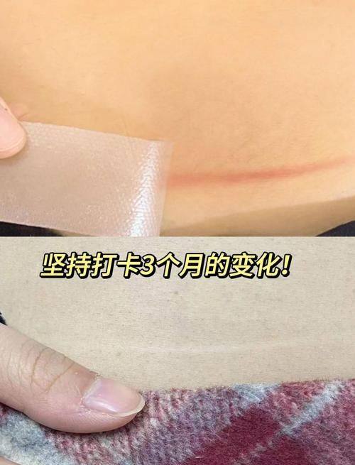 云南省中医医院皮肤科是正规医院吗？