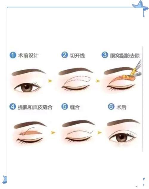 杭州优医联合医美是正规医院吗?